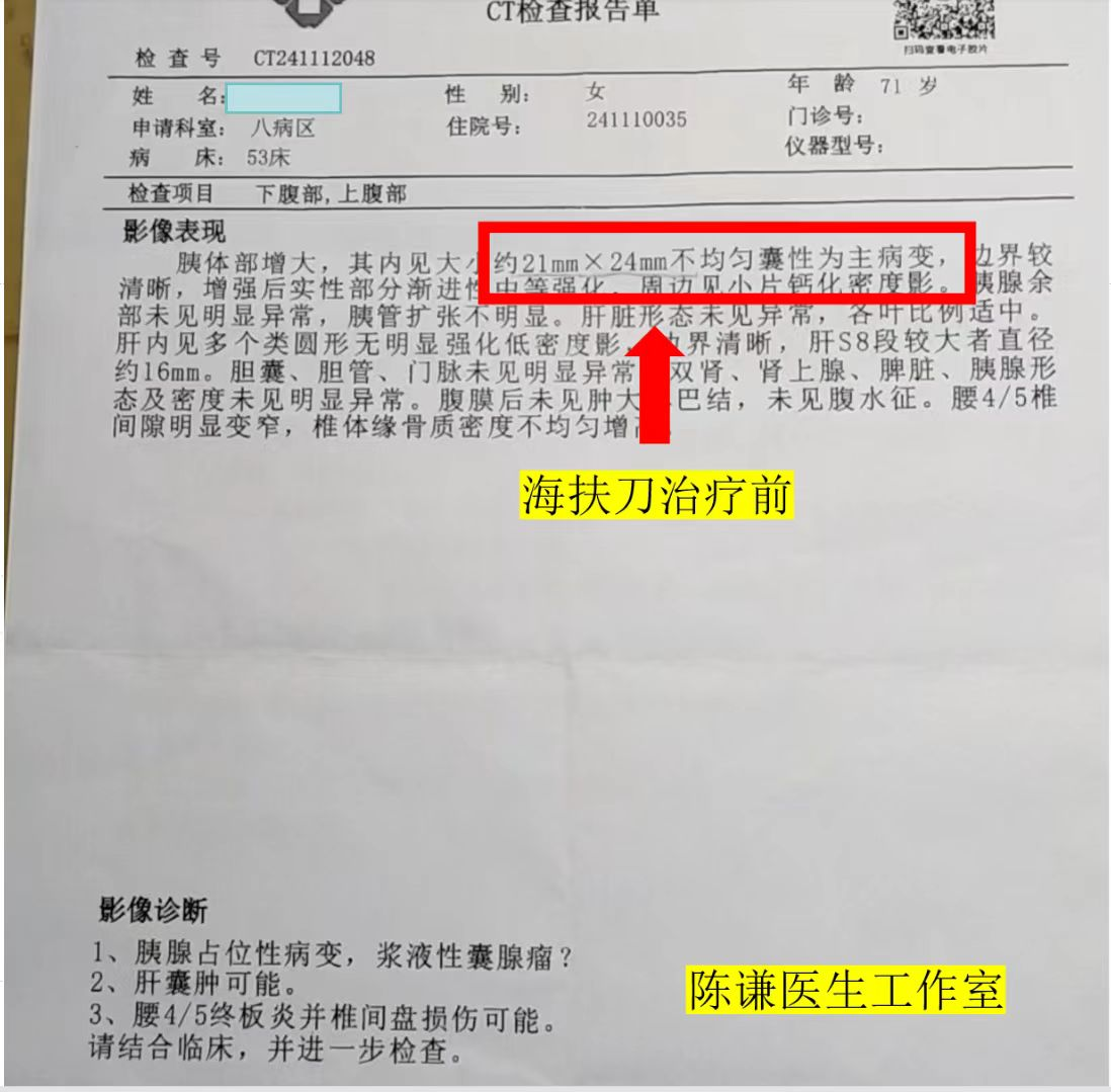 72 岁北京老人跨省求医:胰腺 IPMN 不用开刀,4 个月肿瘤缩小80% 72 岁北京老人跨省求医:胰腺 IPMN 不用开刀,4 个月肿瘤缩小80%