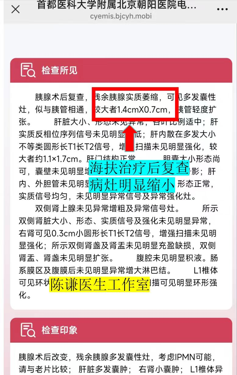 72 岁北京老人跨省求医:胰腺 IPMN 不用开刀,4 个月肿瘤缩小80% 72 岁北京老人跨省求医:胰腺 IPMN 不用开刀,4 个月肿瘤缩小80%
