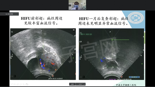 首期“新型冠状病毒肺炎疫情下危急重症的微无创治疗”线上学术会议成功举行