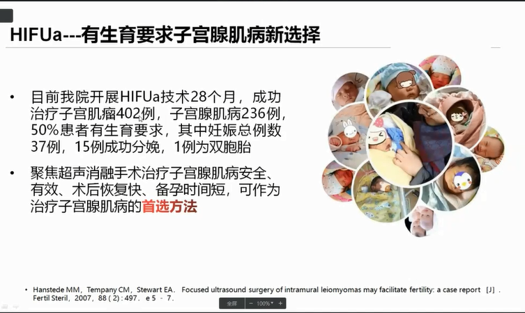 解读热点 疫情期间子宫腺肌病的微无创治疗